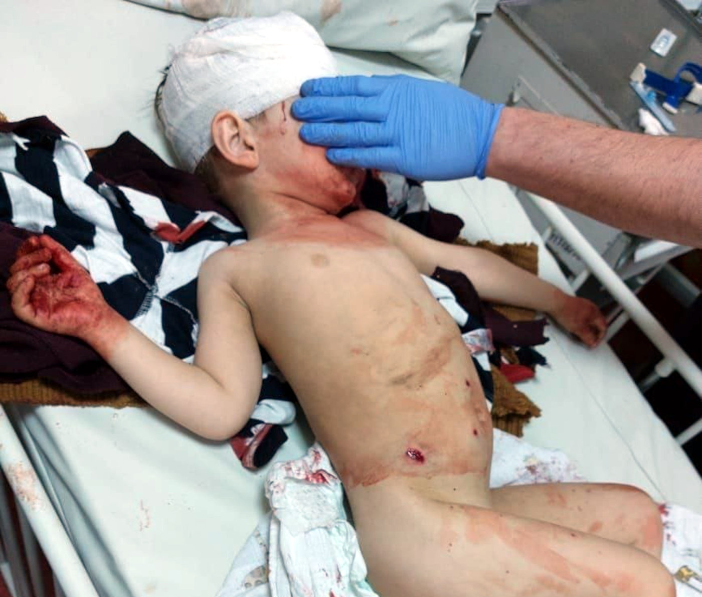 russians killed 512 and injured 1,158 Ukrainian children - Commissioner for Human Rights